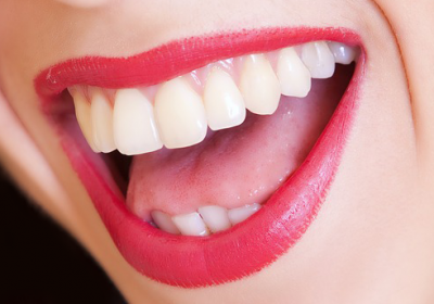 6 month smiles Gwynedd dental practice