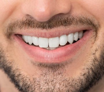 Cosmetic dentistry